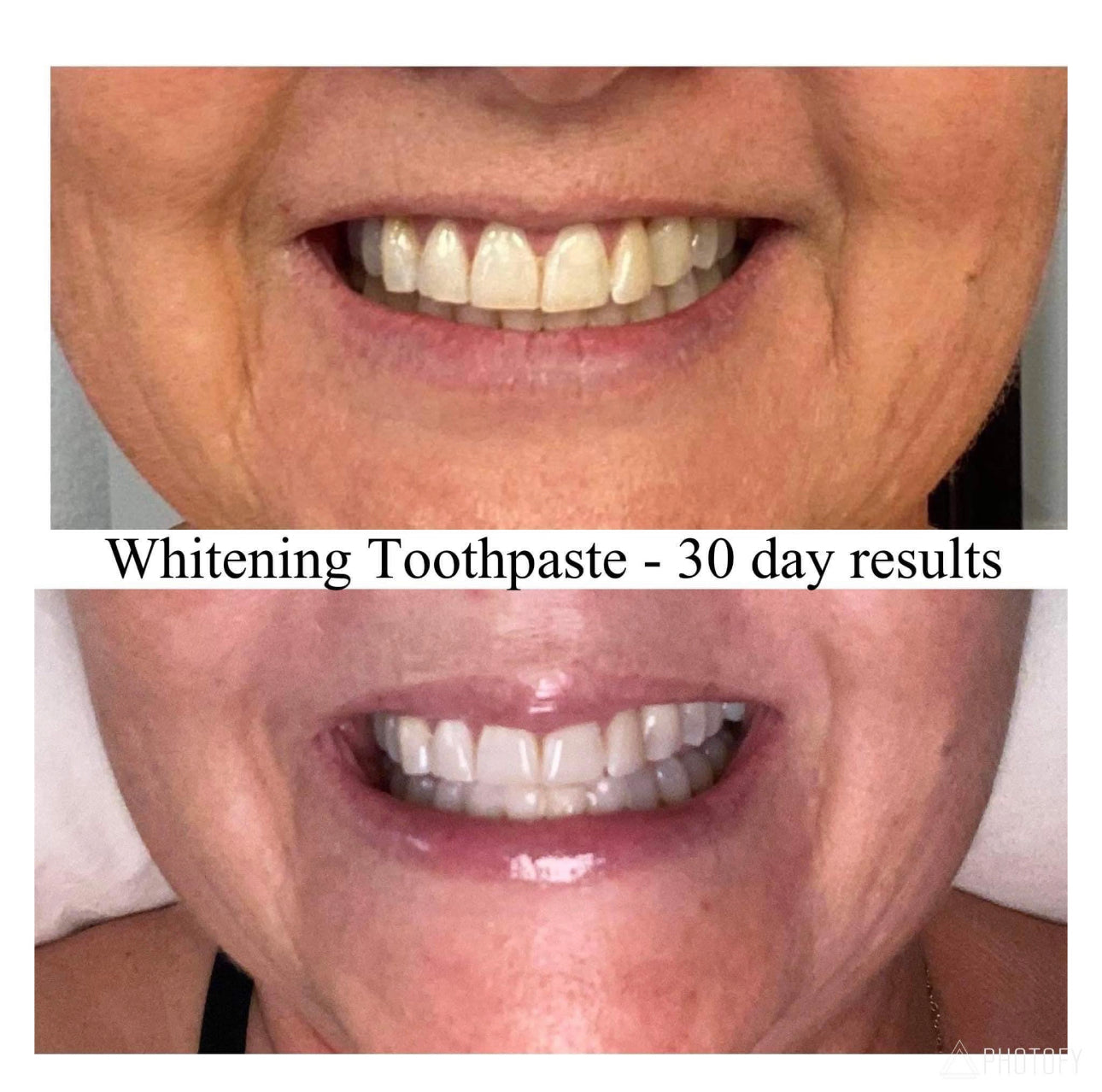 Whitening Toothpaste